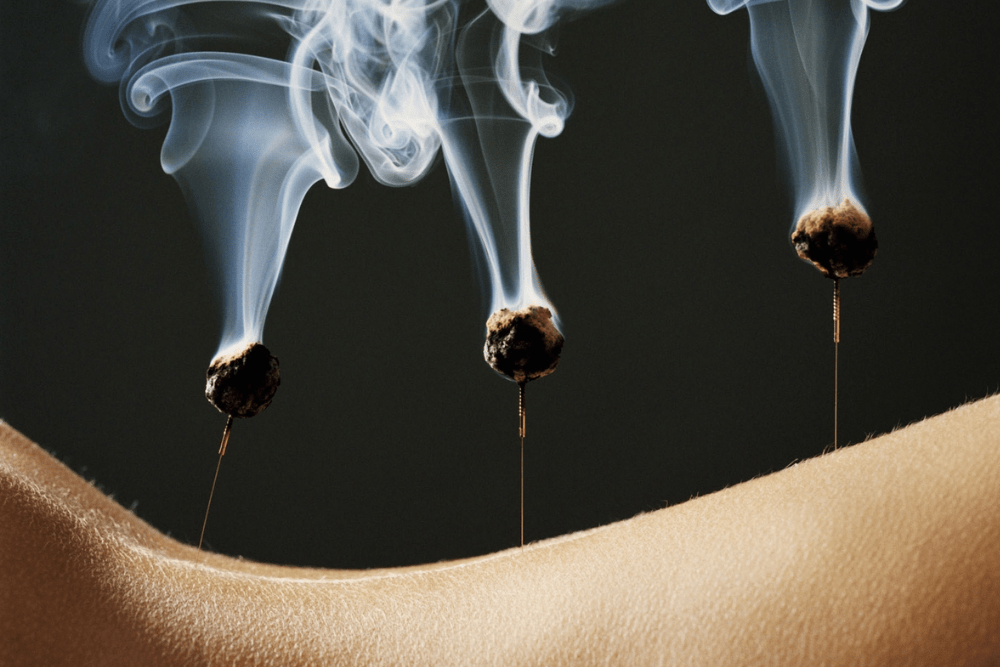 Acupuncture & Moxibustion Miami Beach